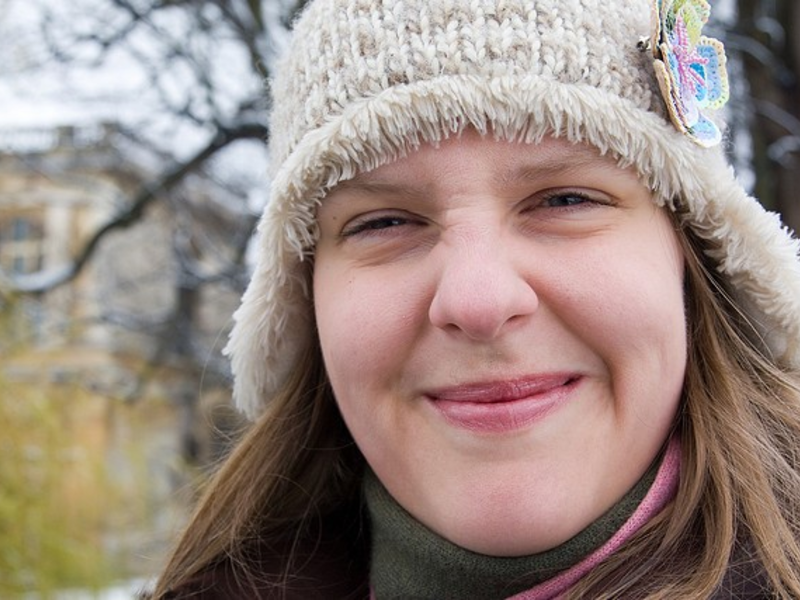 Hautalterung ist ab dem 30. Lebensjahr ein Thema - Foto: Flickr.com (c) MonkeyMishkin (CC BY 2.0)