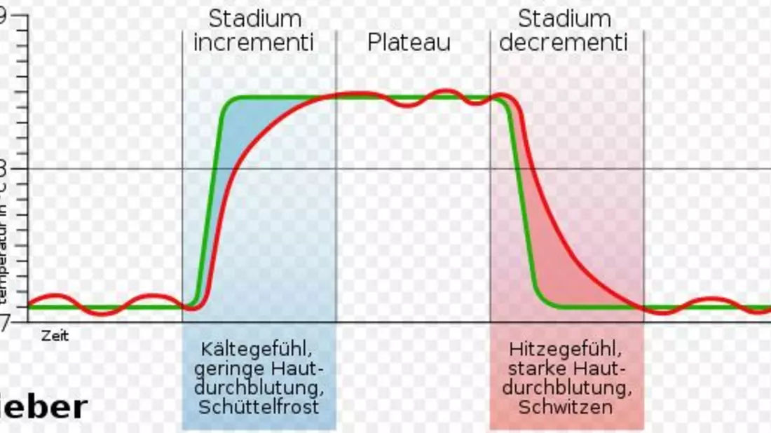 Typische Fieberkurve - Bild: commons.wikimedia.org © DooFi (CC BY-SA 3.0) 