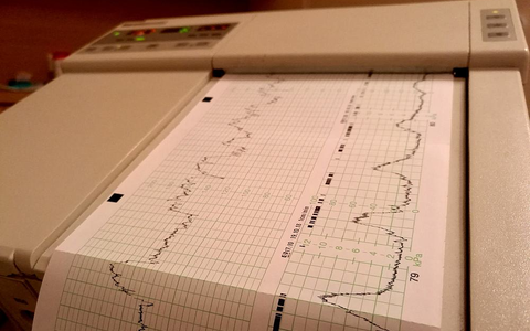 Kardiotokografie im Krankenhaus (Archiv) - Foto: über dts Nachrichtenagentur