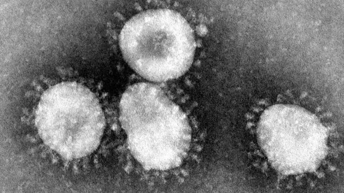 Corona-Virus - Bild: über dts Nachrichtenagentur