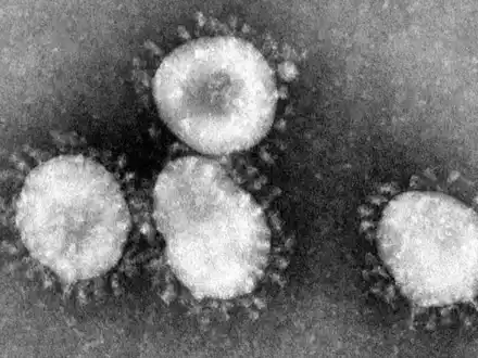 Corona-Virus - Foto: über dts Nachrichtenagentur