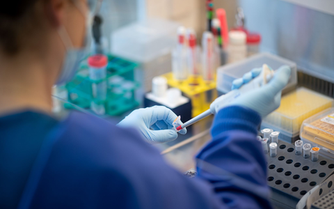 Der Ursprung des Virus Sars-CoV-2 bleibt unklar. (Symbolbild) - Foto: Daniel Reinhardt/dpa