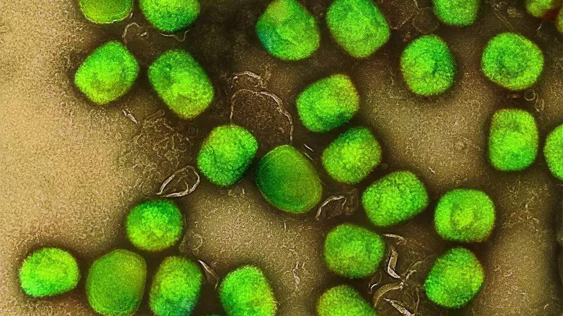 Nach langer Ruhe sind in Deutschland wieder einzelne Infektionen mit dem Virus bestätigt worden. - Bild: Niaid/Niaid/Planet Pix via ZUMA Press Wire/dpa