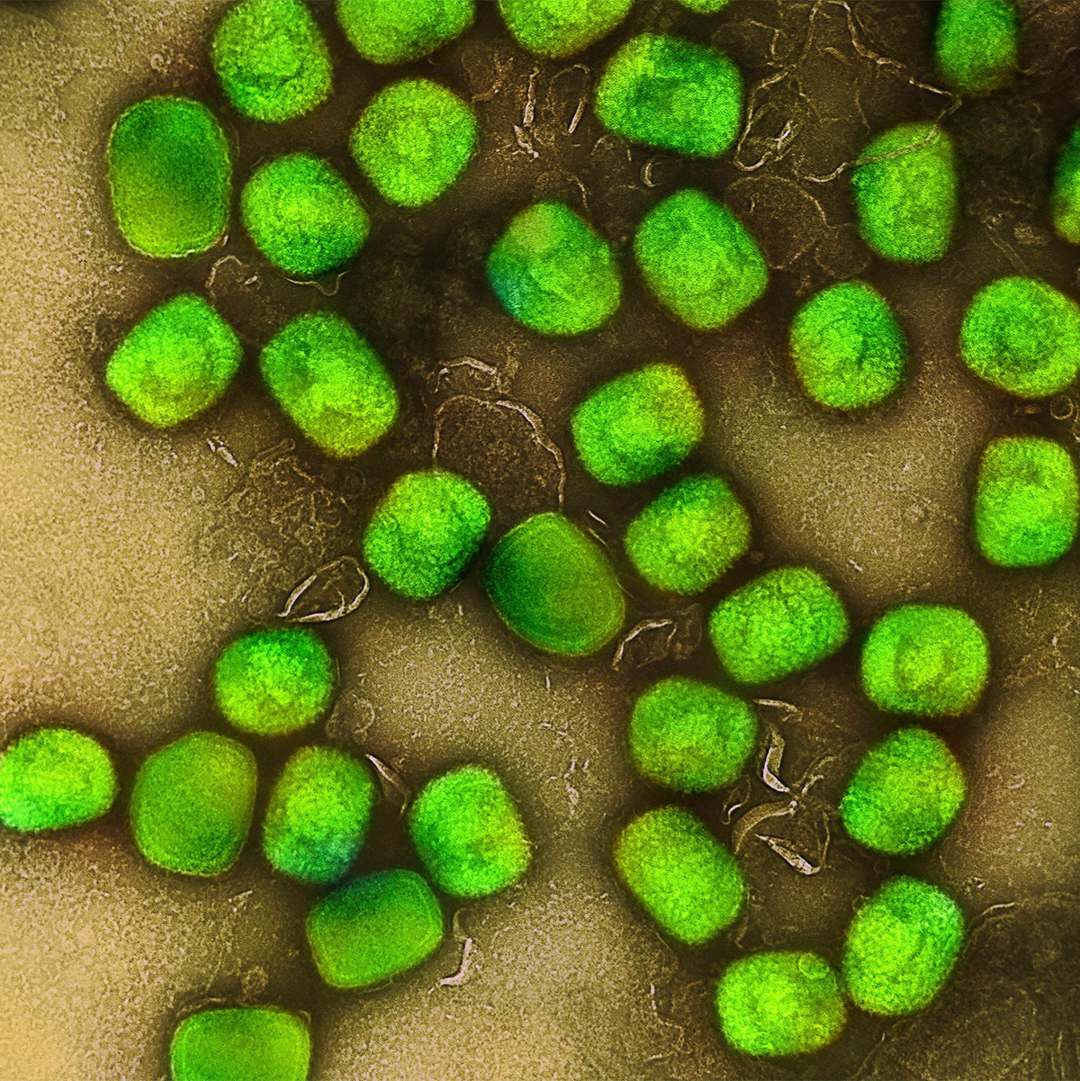 Eine kolorierte transmissionselektronenmikroskopische Aufnahme von Partikeln des Affenpockenvirus. - Foto: Niaid/Niaid/Planet Pix via ZUMA Press Wire/dpa