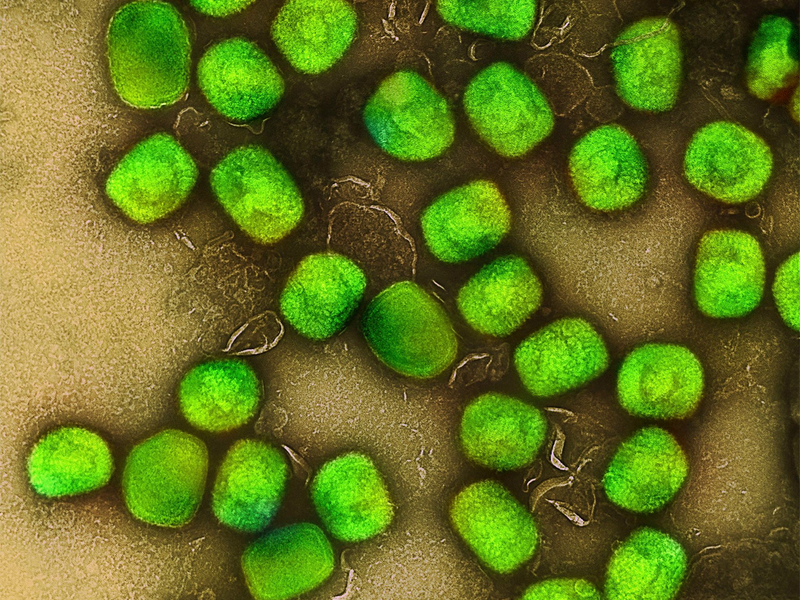 In Deutschland ist zum zweiten Mal die neue Variante des Mpox-Virus nachgewiesen worden. (Archivbild) - Foto: Niaid/Niaid/Planet Pix via ZUMA Press Wire/dpa