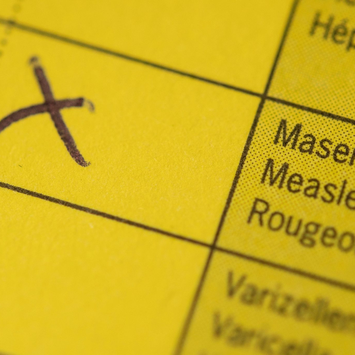 Impfungen gegen Masern sind auch in Deutschland empfohlen. (Symbolbild) - Foto: Marius Becker/dpa