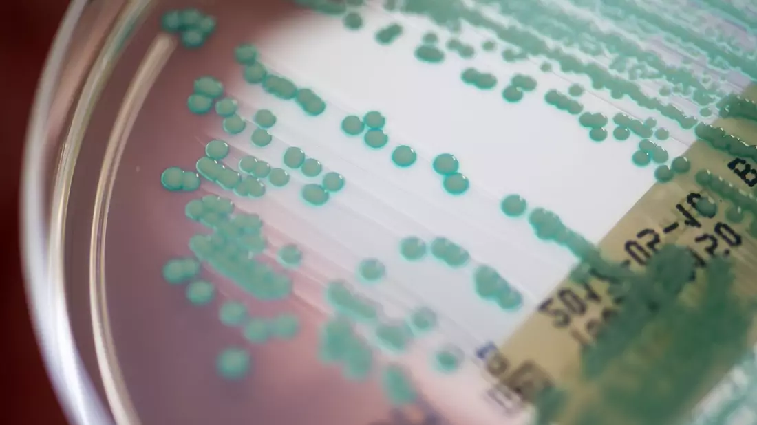 Die Zahl der Todesfälle, bei denen multiresistente Keime eine Rolle spielen, könnte von 4,71 Millionen auf 8,22 Millionen steigen. (Archivbild) - Bild: Armin Weigel/dpa
