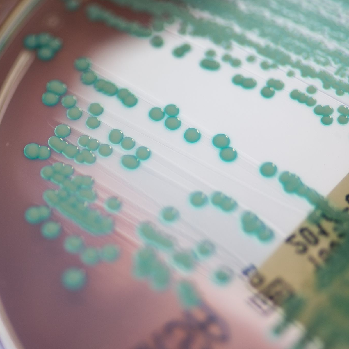 Die Zahl der Todesfälle, bei denen multiresistente Keime eine Rolle spielen, könnte von 4,71 Millionen auf 8,22 Millionen steigen. (Archivbild) - Foto: Armin Weigel/dpa