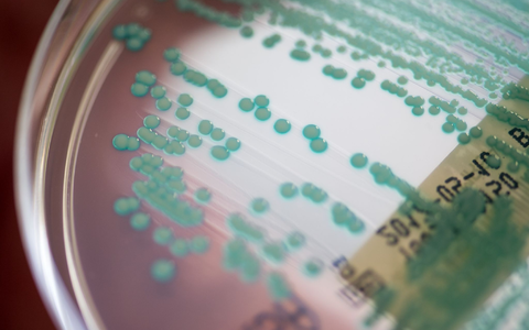 Die Zahl der Todesfälle, bei denen multiresistente Keime eine Rolle spielen, könnte von 4,71 Millionen auf 8,22 Millionen steigen. (Archivbild) - Foto: Armin Weigel/dpa