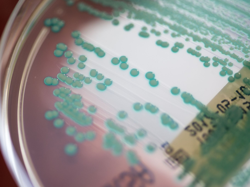 Die Zahl der Todesfälle, bei denen multiresistente Keime eine Rolle spielen, könnte von 4,71 Millionen auf 8,22 Millionen steigen. (Archivbild) - Foto: Armin Weigel/dpa