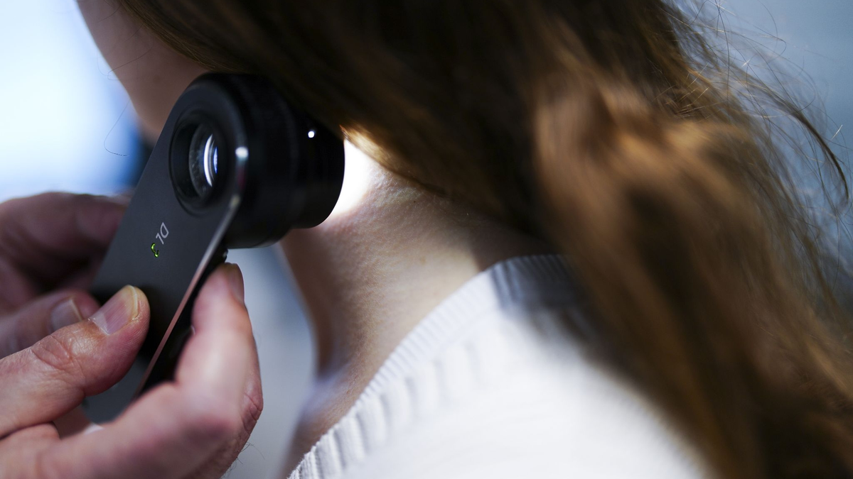 Ein Hautarzt untersucht bei einer Krebsvorsorgeuntersuchung eine Patientin mit einem Auflichtmikroskop. - Foto: Eva Manhart/APA/dpa