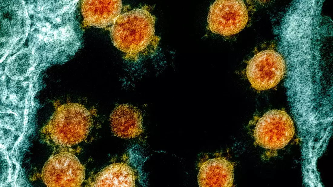 Partikel des Coronavirus SARS-CoV-2 wurden für eine elektronenmikroskopische Aufnahme farblich bearbeitet. - Bild: Uncredited/NIAID/NIH/dpa