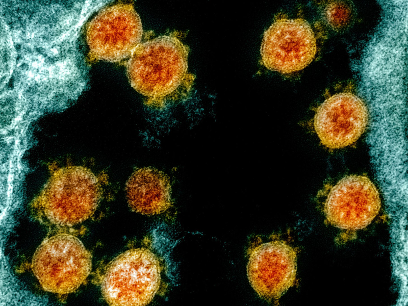 Elektronenmikroskopische Aufnahme des Coronavirus SARS-CoV-2. - Foto: Uncredited/NIAID/NIH/dpa