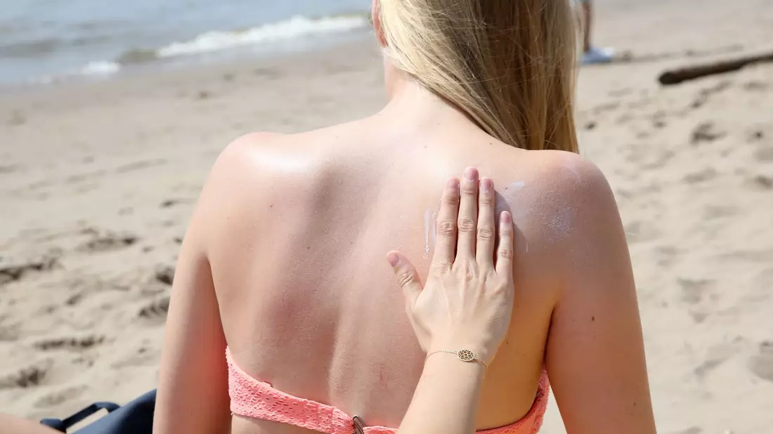 «Das Risiko, einen Sonnenbrand zu bekommen, ist abhängig vom Sonnenstand und in den Sommermonaten von Juni bis August sowie in der Mittagszeit zwischen 11 und 15 Uhr besonders hoch», sagte der Dermatologe Mark Berneburg der Deutschen Presse-Agentur. - Bild: Bodo Marks/dpa