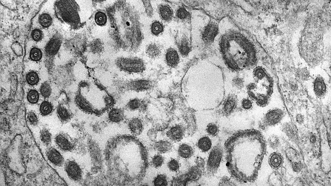 Die Transmissionselektronenmikroskopie (TEM) einer Gewebeprobe zeigt das Vorhandensein zahlreicher Marburg-Viruspartikel. - Bild: Fred Murphy/CDC/dpa