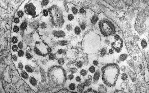 Die Transmissionselektronenmikroskopie (TEM) einer Gewebeprobe zeigt das Vorhandensein zahlreicher Marburg-Viruspartikel. - Foto: Fred Murphy/CDC/dpa