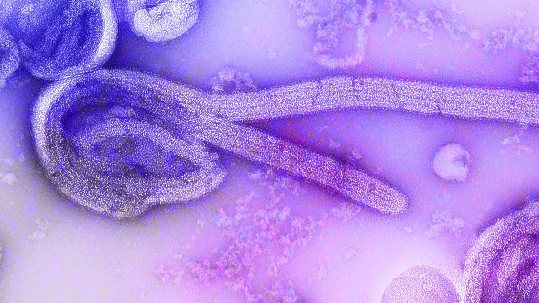 Eine elektronenmikroskopische Aufnahme eines  Marburg-Virus. - Bild: Dr. Frederick Murphy/CDC/dpa