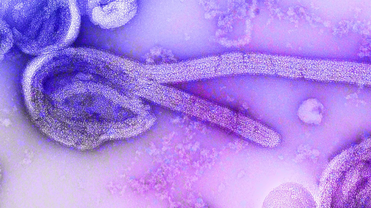 Eine elektronenmikroskopische Aufnahme eines  Marburg-Virus. - Foto: Dr. Frederick Murphy/CDC/dpa