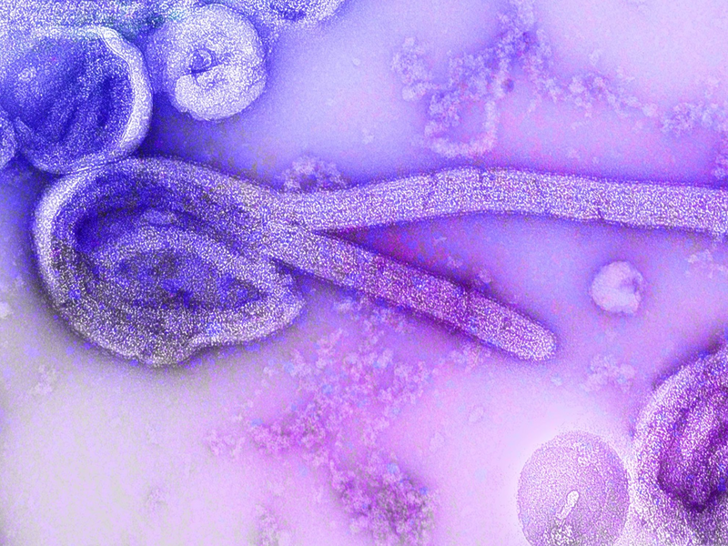 Eine elektronenmikroskopische Aufnahme eines  Marburg-Virus. - Foto: Dr. Frederick Murphy/CDC/dpa