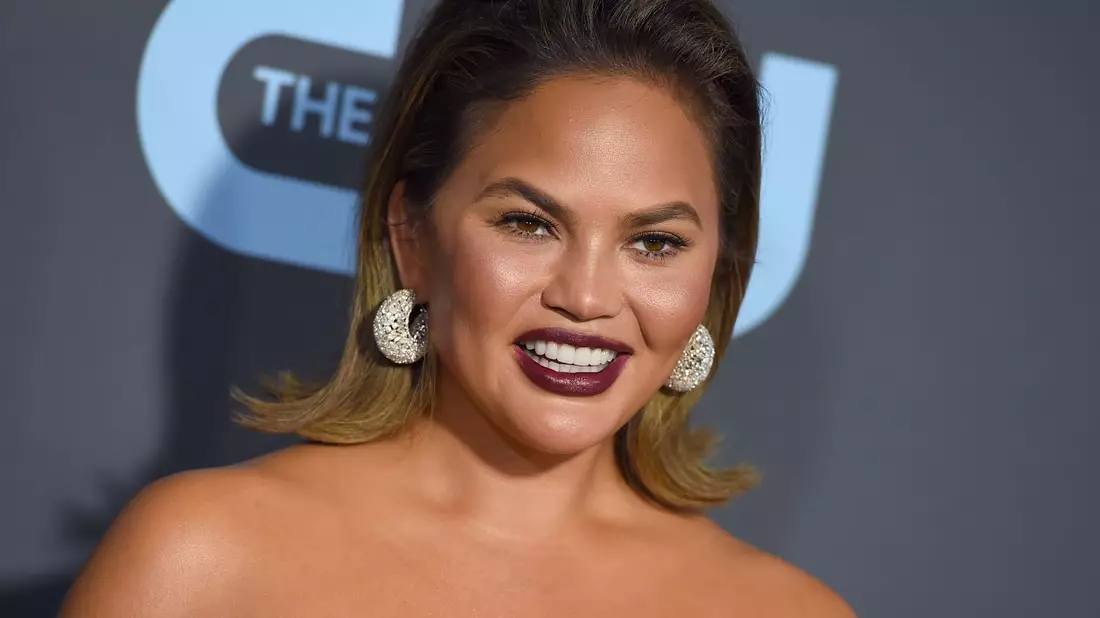 Chrissy Teigen über Buccal Fat Removal: «Ja, ich habe es getan, na und?» - Bild: Jordan Strauss/Invision/AP/dpa
