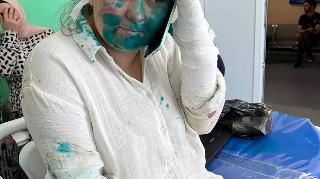 Die Journalistin Jelena Milaschina ist nach der Attacke in Tschetschenien von Kollegen nach Moskau gebracht worden. - Bild: Uncredited/Novaya Gazeta Europe Novayagazeta.eu/AP/dpa