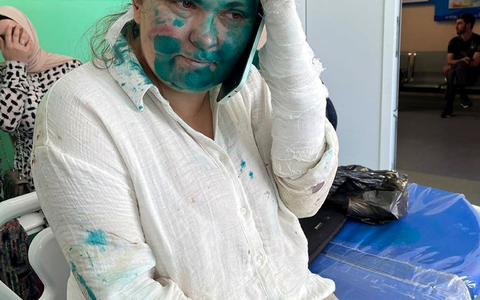 Die Journalistin Jelena Milaschina ist nach der Attacke in Tschetschenien von Kollegen nach Moskau gebracht worden. - Foto: Uncredited/Novaya Gazeta Europe Novayagazeta.eu/AP/dpa