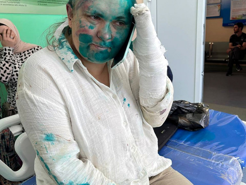 Die Journalistin Jelena Milaschina ist nach der Attacke in Tschetschenien von Kollegen nach Moskau gebracht worden. - Foto: Uncredited/Novaya Gazeta Europe Novayagazeta.eu/AP/dpa