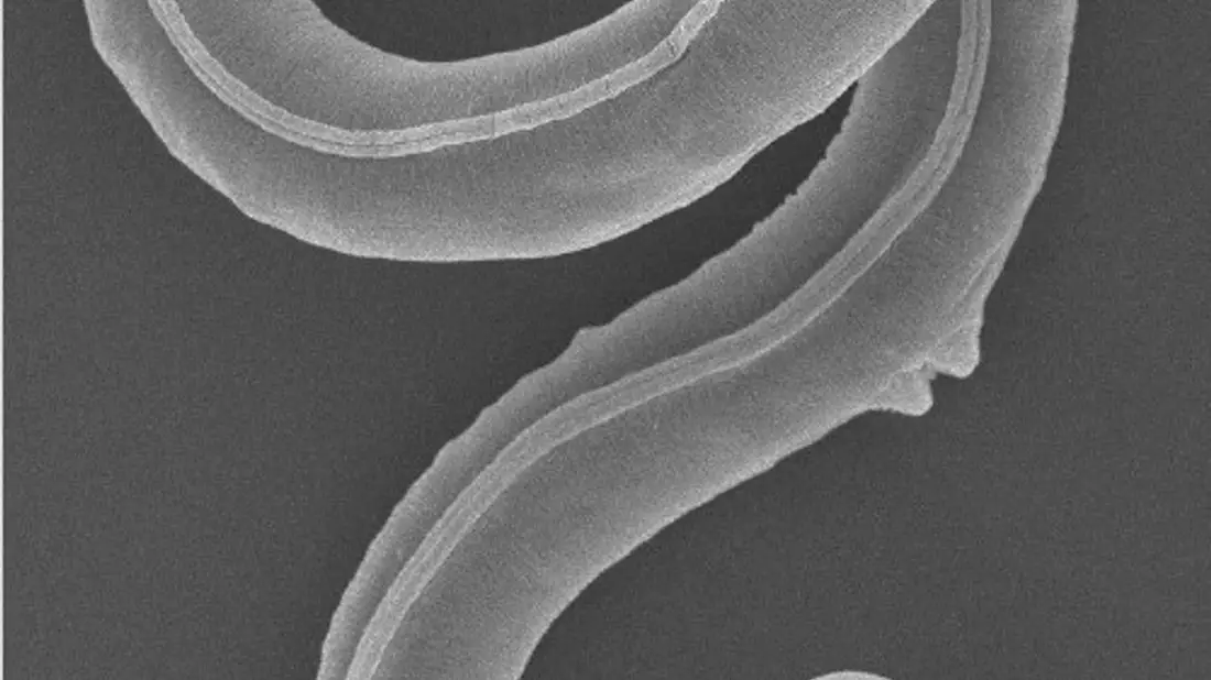 Ein Fadenwurm (Panagrolaimus kolymaensis) auf einem Rasterelektronenbild. - Bild: A. V. Tchesunov/A. Shatilovich/Institute of Physicochemical and Biological Problems in Soil Science RAS/dpa
