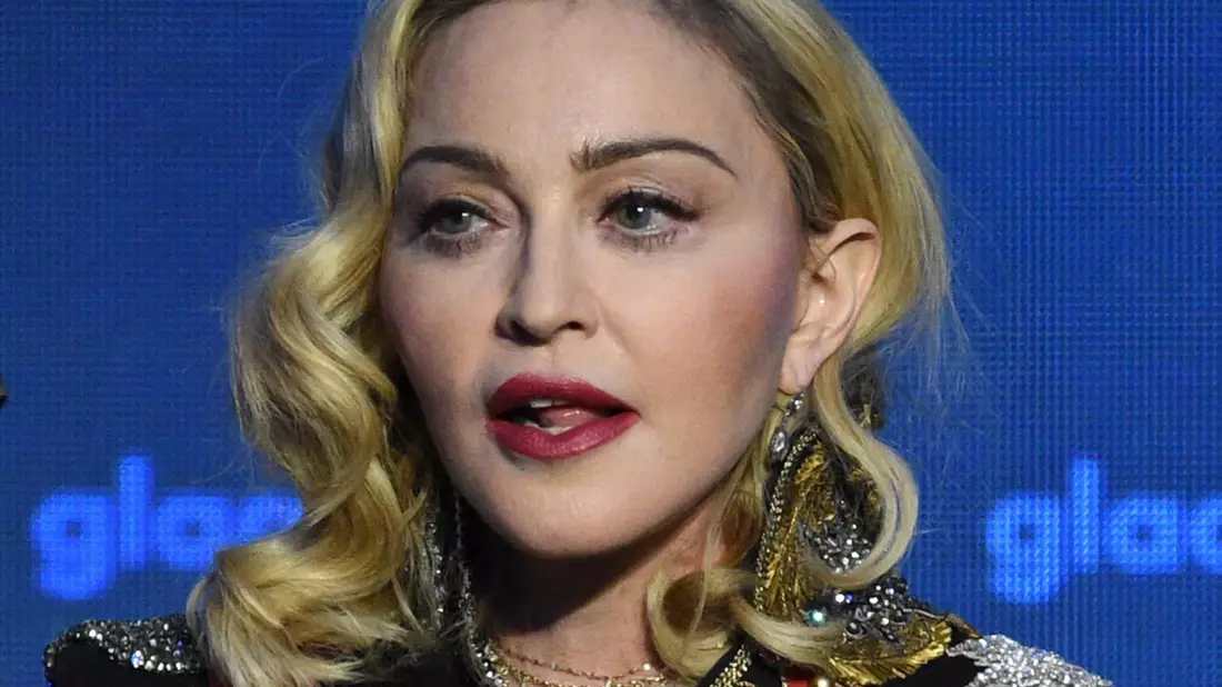 Popstar Madonna ist nach einer schweren bakteriellen Infektion wieder auf dem Weg der Besserung. - Bild: Evan Agostini/Invision/AP/dpa
