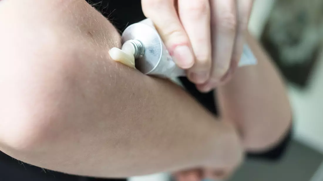 In einer Studie wurden der Einfluss von geringen Cortison-Mengen auf den Blutdruck und das Gewicht von Rheuma-Patienten untersucht. - Bild: Franziska Gabbert/dpa