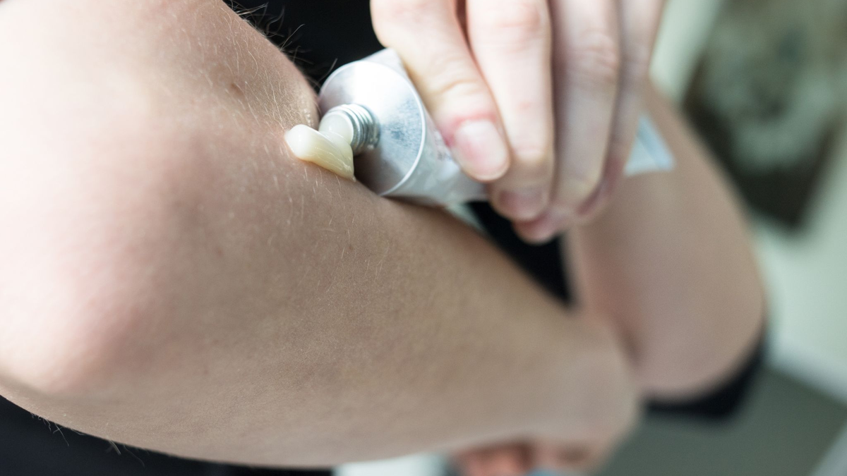 In einer Studie wurden der Einfluss von geringen Cortison-Mengen auf den Blutdruck und das Gewicht von Rheuma-Patienten untersucht. - Foto: Franziska Gabbert/dpa