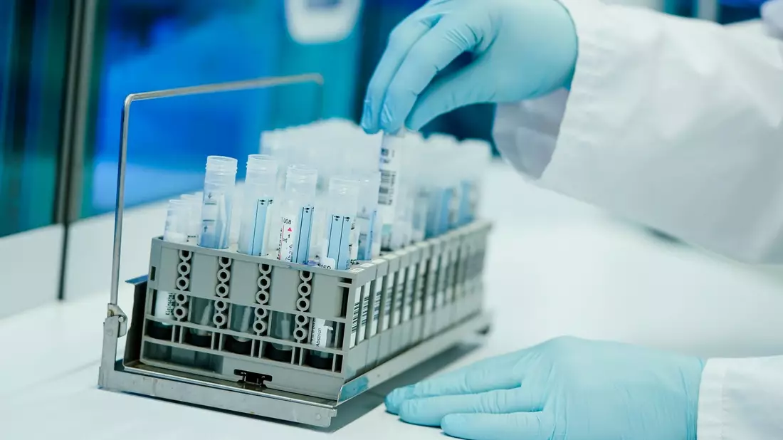 Ein Mitarbeiter hält in einem Coronatest-Labor der Limbach Gruppe PCR-Teströhrchen in den Händen. Die Zahl der im Labor bestätigten Corona-Fälle in Deutschland steigt wieder, allerdings auf relativ niedrigem Niveau. - Bild: Uwe Anspach/dpa