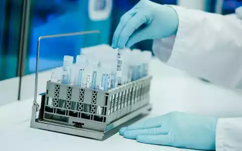 Ein Mitarbeiter hält in einem Coronatest-Labor der Limbach Gruppe PCR-Teströhrchen in den Händen. Die Zahl der im Labor bestätigten Corona-Fälle in Deutschland steigt wieder, allerdings auf relativ niedrigem Niveau. - Foto: Uwe Anspach/dpa