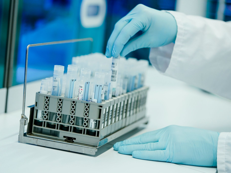 Ein Mitarbeiter hält in einem Coronatest-Labor der Limbach Gruppe PCR-Teströhrchen in den Händen. Die Zahl der im Labor bestätigten Corona-Fälle in Deutschland steigt wieder, allerdings auf relativ niedrigem Niveau. - Foto: Uwe Anspach/dpa