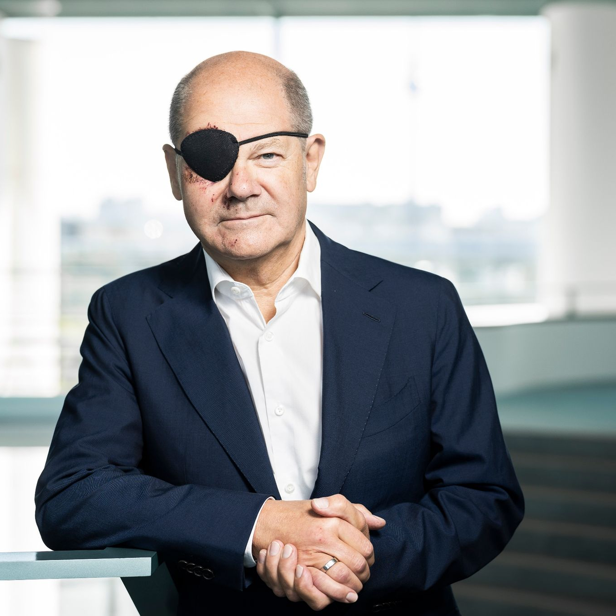 Bundeskanzler Olaf Scholz (SPD) mit Augenklappe, die er aufgrund einer Sportverletzung trägt. - Foto: Steffen Kugler/Bundesregierung/dpa