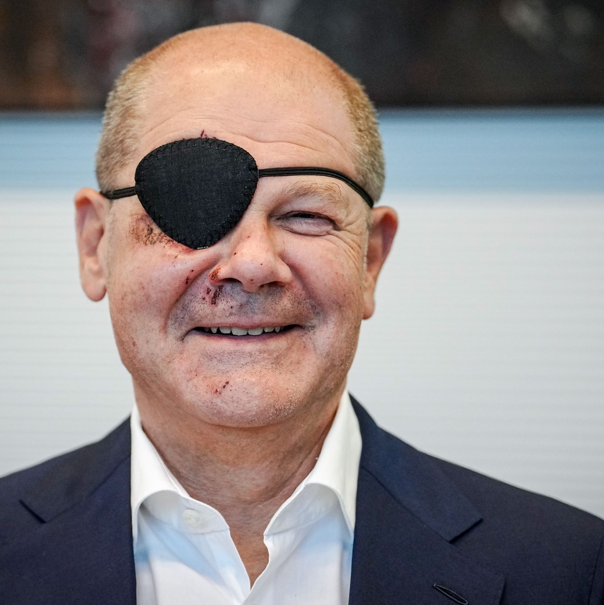 Nach einem Sportunfall nimmt Bundeskanzler Olaf Scholz (SPD) mit Augenklappe an der Fraktionssitzung seiner Partei teil. - Foto: Kay Nietfeld/dpa