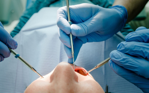 «Die sitzen beim Arzt und lassen sich die Zähne neu machen, und die deutschen Bürger nebenan kriegen keine Termine», sagt CDU-Chef Merz im «Welt-Talk» des gleichnamigen Fernsehsenders - und sorgt damit für Wirbel. - Foto: Markus Scholz/dpa/Illustration