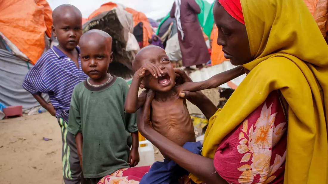 Eine Mutter, die aus der von Dürre heimgesuchten Region Lower Shabelle geflohen ist, hält ihre unterernährte Tochter in einem Lager für Vertriebene. - Bild: Farah Abdi Warsameh/AP/dpa