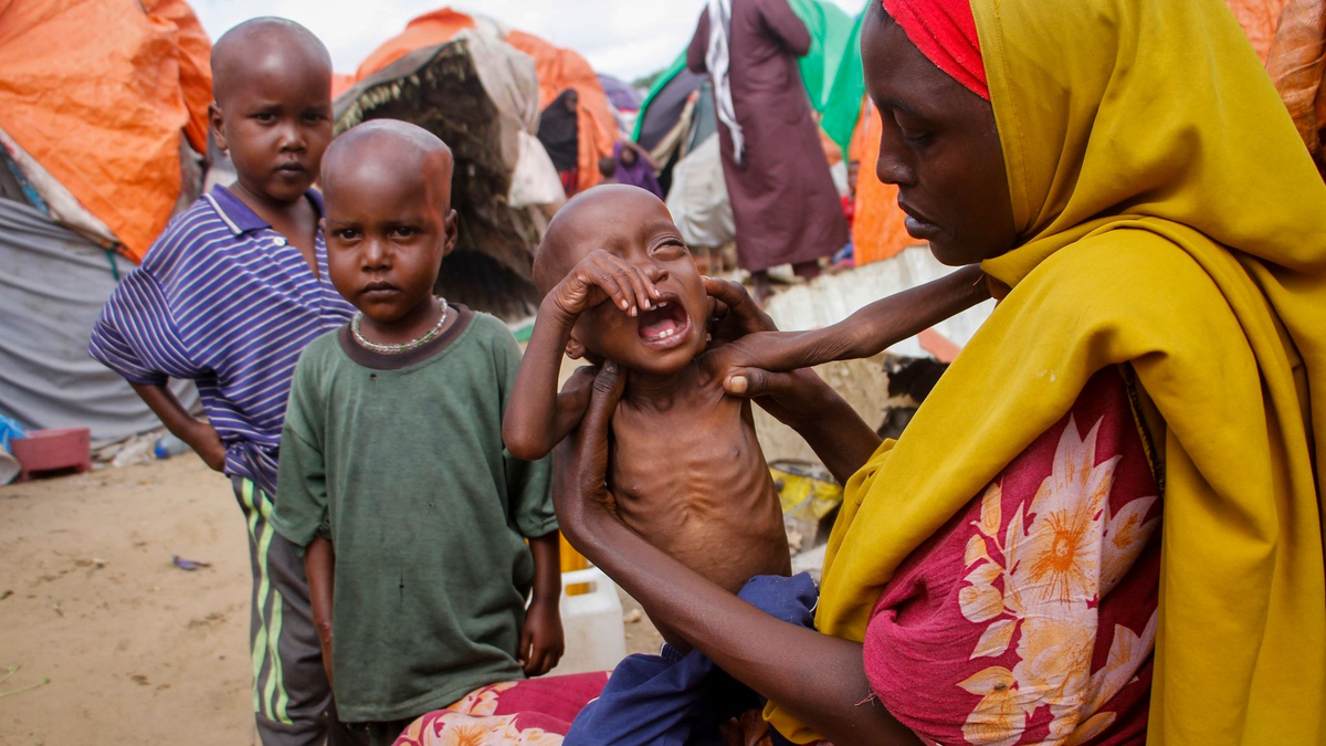 Eine Mutter, die aus der von Dürre heimgesuchten Region Lower Shabelle geflohen ist, hält ihre unterernährte Tochter in einem Lager für Vertriebene. - Foto: Farah Abdi Warsameh/AP/dpa