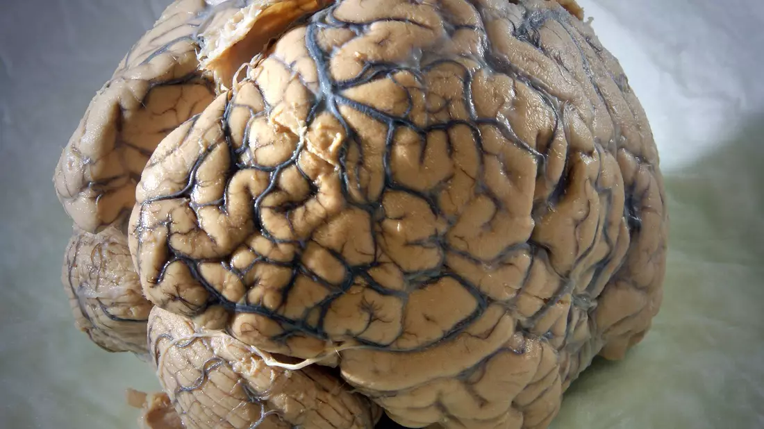 Ein Gehirn des Menschen in einem Labor der Klinik für Neurologie am Universitätsklinikum Jena. - Bild: Jan-Peter Kasper/dpa-Zentralbild/dpa