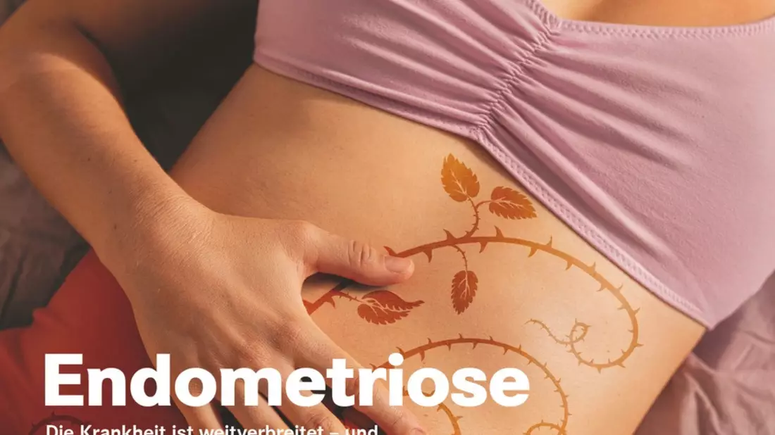 Endometriose: Viele Frauen leiden während der Periode / Noch immer weiß die Medizin zu wenig über die chronisch-entzündliche Erkrankung / Doch allmählich rückt sie stärker in den Fokus der Forschung - Bild: presseportal.de