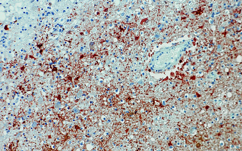 Die undatierte Aufnahme zeigt einen Anitkörpernachweis zum Borna-Virus im Gewebe. - Foto: Bernhard-Nocht-Institut für Tropenmedizin/dpa