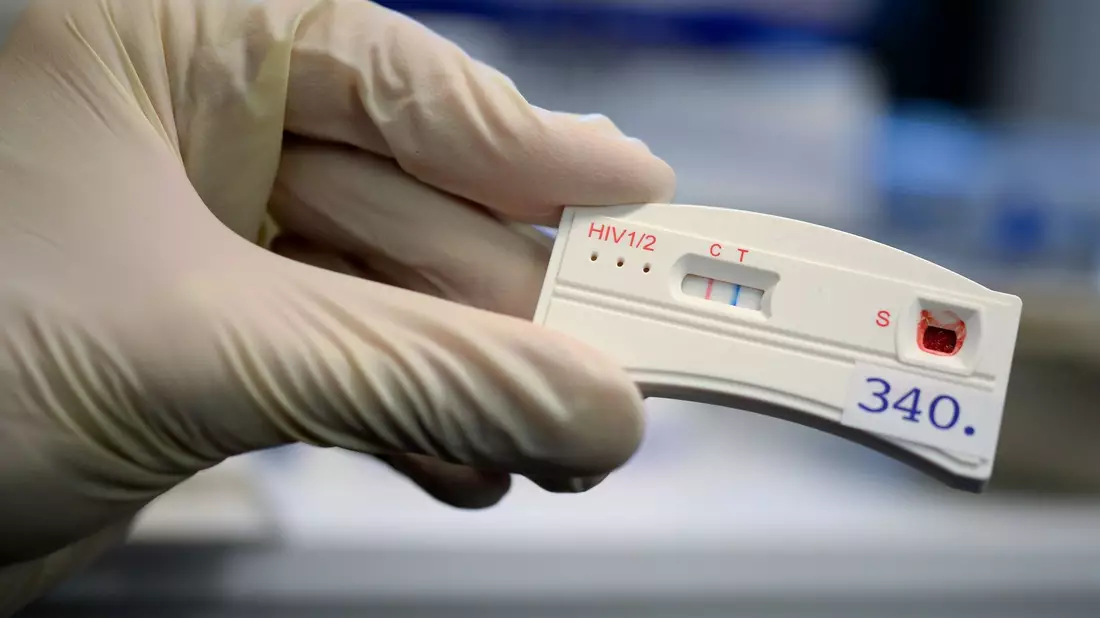 Der Teststreifen an einem HIV-Schnelltest verfärbt sich bei der Berliner Aids-Hilfe nach der Anwendung mit dem Blut einer Testperson. - Bild: Britta Pedersen/dpa-Zentralbild/dpa