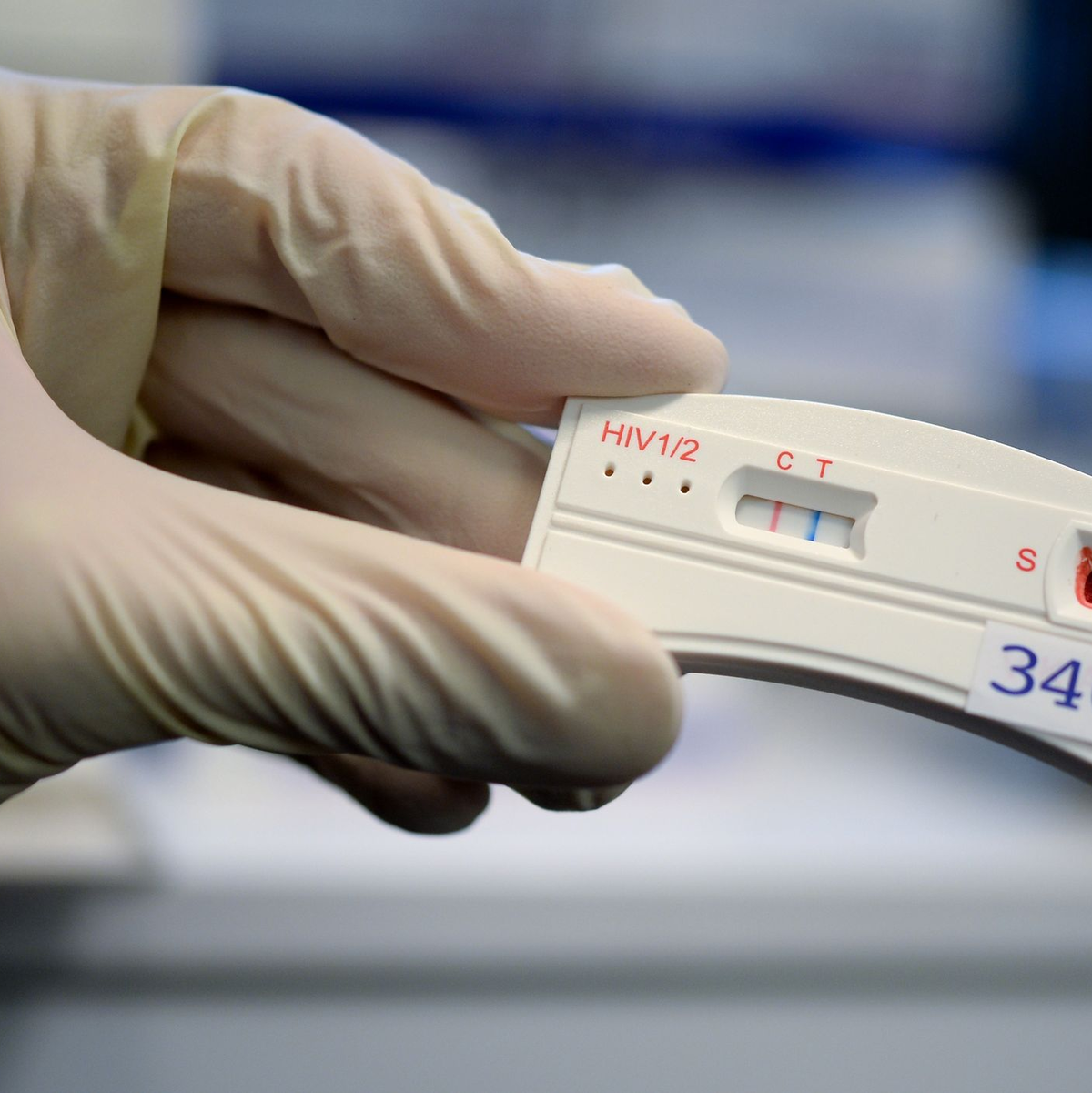 Ein Schnelltest hilft bein der Erkennung einer HIV-Infektion. (Aschivbild) - Foto: Britta Pedersen/dpa-Zentralbild/dpa