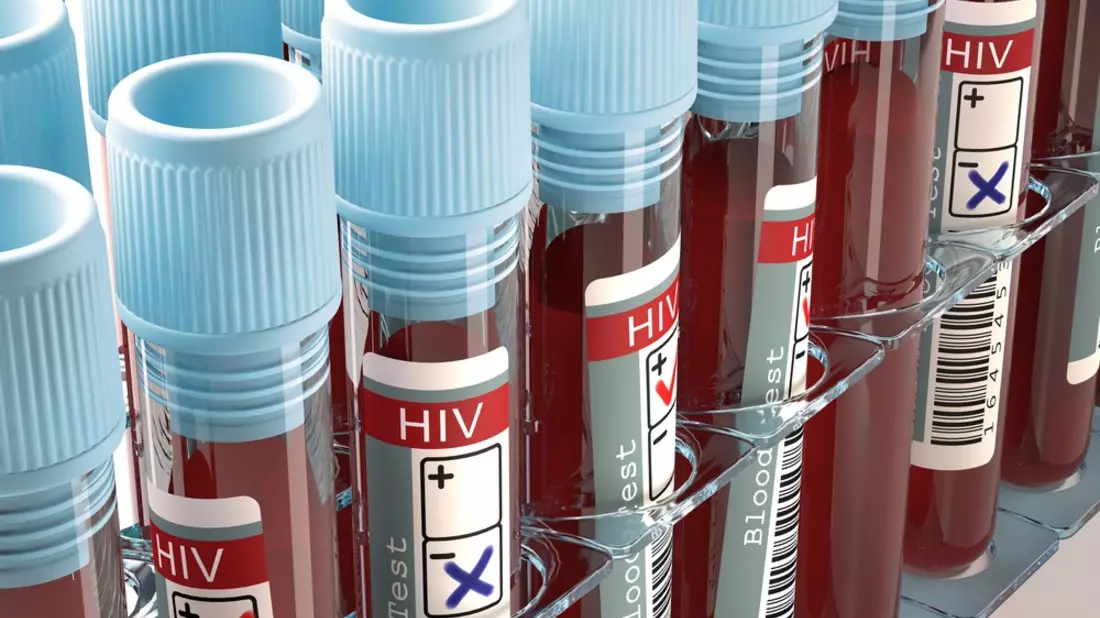 Mit HIV alt werden - Fortschritte in der AIDS-Therapie - Bild: presseportal.de