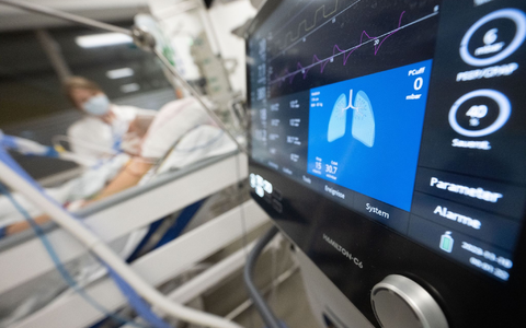 Forscher haben die Langzeitfolgen einer Grippe-Infektion näher untersucht. - Foto: Marijan Murat/dpa