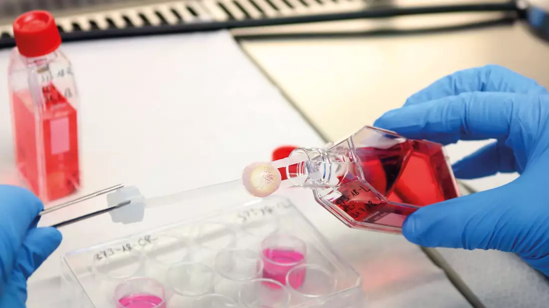 Ein Augenhornhaut-Transplantat wird von einem Labormitarbeitenden bearbeitet. - Bild: --/DGFG/dpa