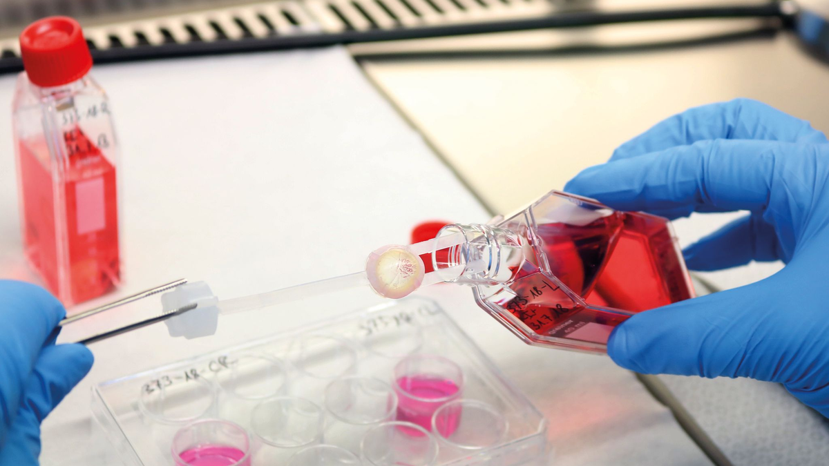 Ein Augenhornhaut-Transplantat wird von einem Labormitarbeitenden bearbeitet. - Foto: --/DGFG/dpa