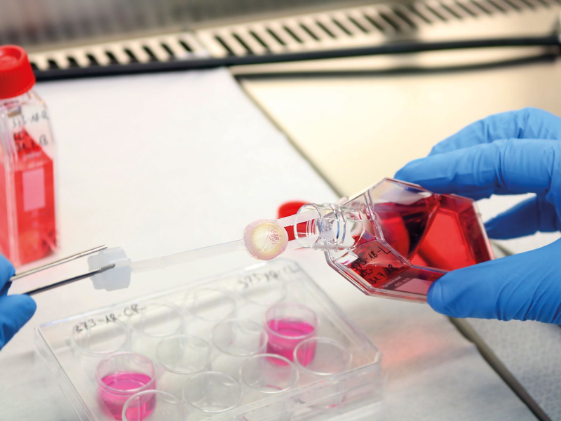 Ein Augenhornhaut-Transplantat wird von einem Labormitarbeitenden bearbeitet. - Foto: --/DGFG/dpa