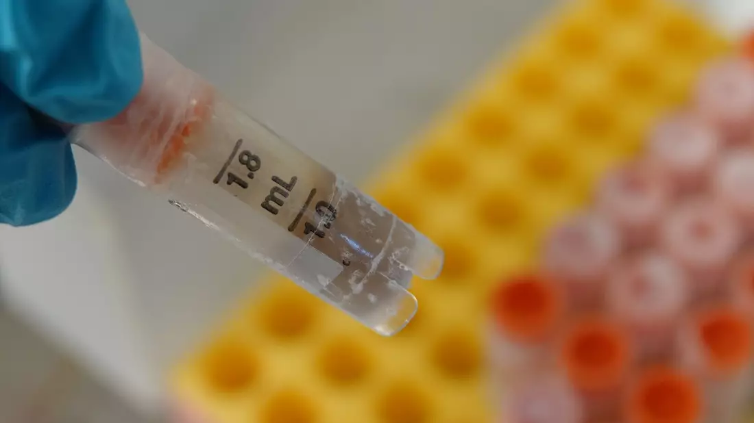 Eine eingefrorene Stuhlprobe in einem Gläschen. - Bild: Christiane Oelrich/dpa
